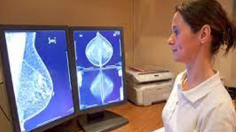 Les Gènes et le Cancer du Sein : Ce que Vous Devez Savoir